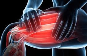 Delayed-Onset Muscle Soreness (DOMS)