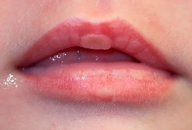 Credits: emedicine health 