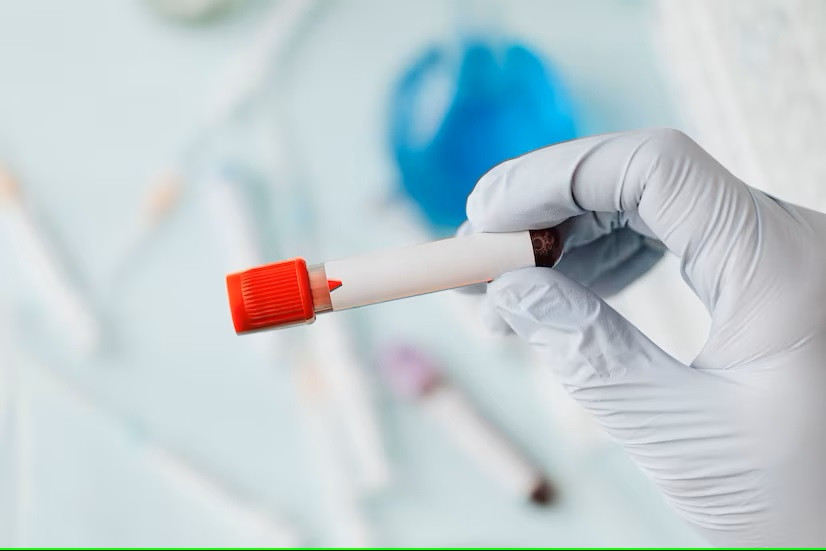 Mengetahui Golongan Darah Sangatlah Penting, Ini Alasannya