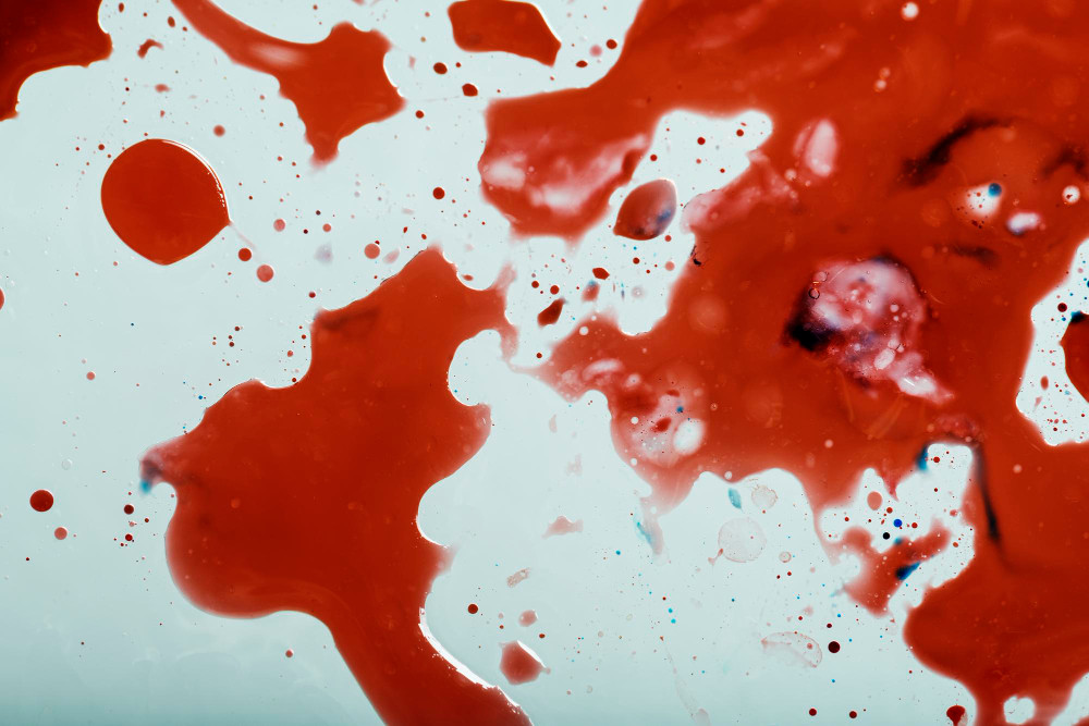 Mengeluarkan Keringat Darah (Hematohidrosis), Berbahayakah?