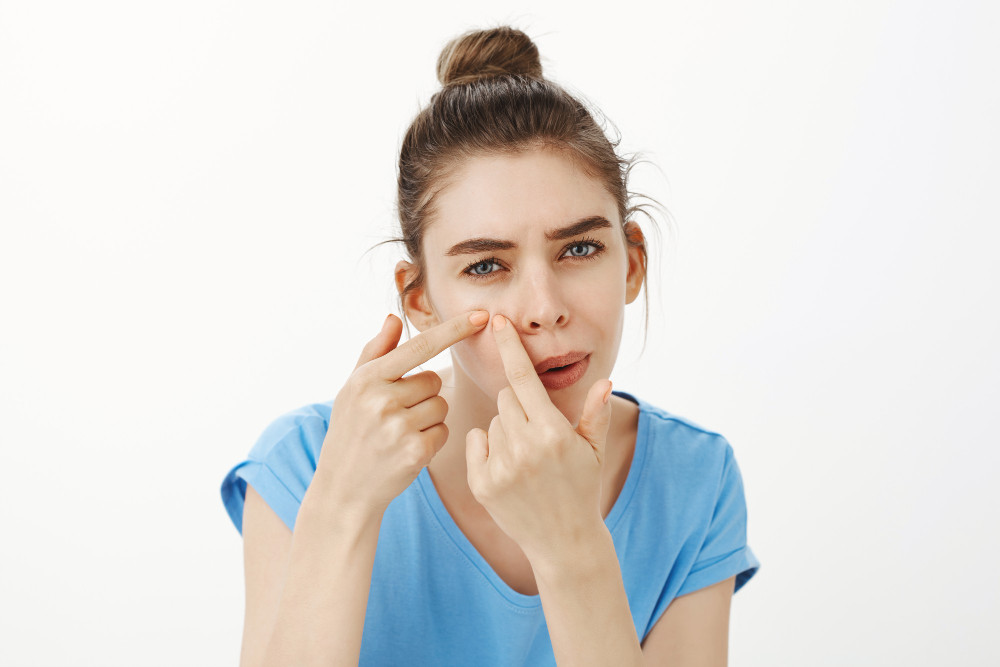 Acne Patch untuk Mengatasi Jerawat, Benarkah Efektif?